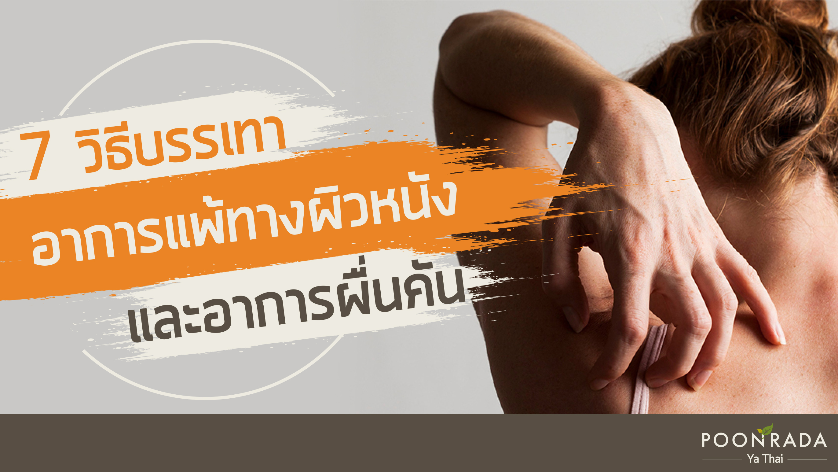 7 วิธีบรรเทาอาการแพ้ทางผิวหนังและอาการผื่นคัน