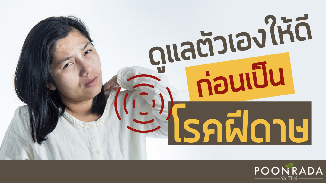 ดูแลตัวเองให้ดี ก่อนเป็น "โรคฝีดาษ"