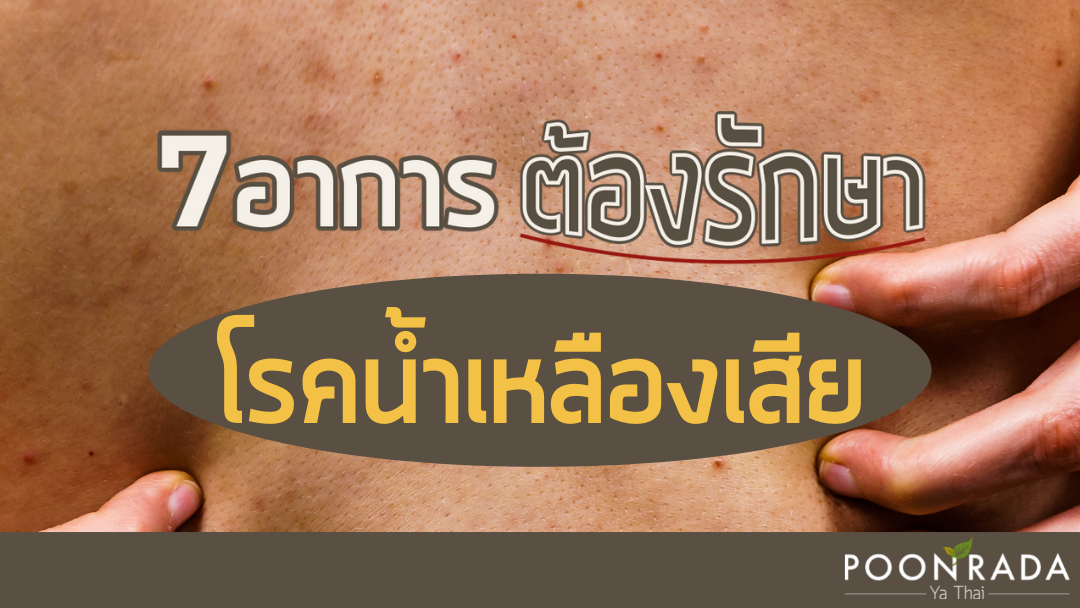 7 อาการต้องรักษา โรคน้ำเหลืองเสีย